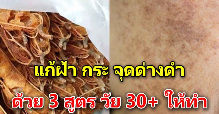 3 วิธีลบฝ้า กระ บนใบหน้า ให้เรียบเนียน ผู้หญิงเก็บไว้ทำ