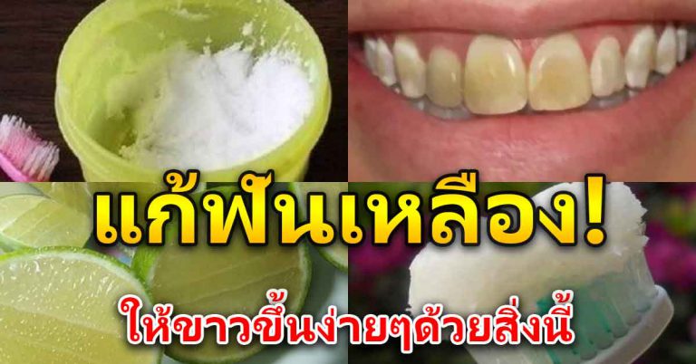 ตัวช่วยให้ฟันขาว ใช้ของที่มีในห้องครัว ไม่กลับมาเหลือง