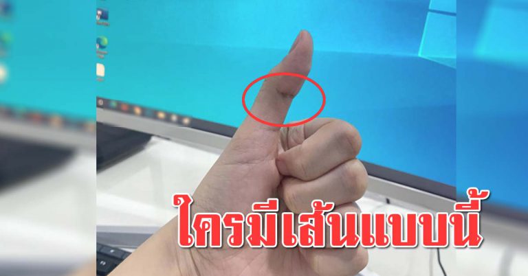 นิ้วหัวแม่มือข้างซ้าย ใครที่เป็นแบบนี่ เชื่อว่ามีสิ่งที่พิเศษ