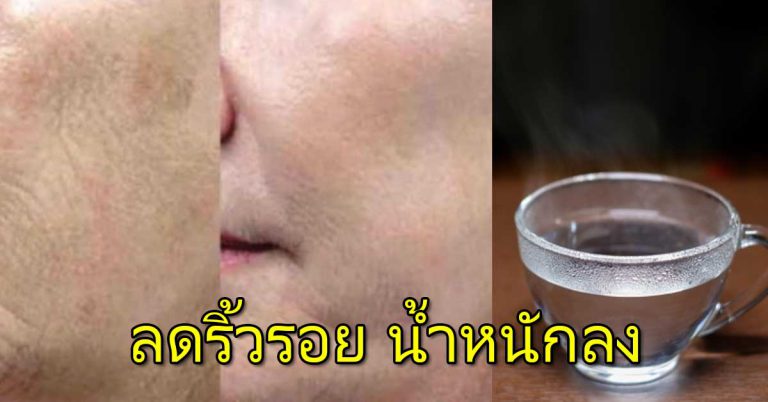 น้ำอุ่น ดื่ม1แก้วทุกเช้า ลดริ้วรอยบนผิวหน้า ประโยชน์อื่นเพียบ